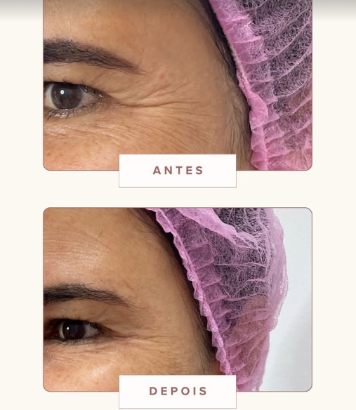 Depoimento de cliente 4